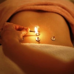 Moxibustion For Chinese Accupuncture