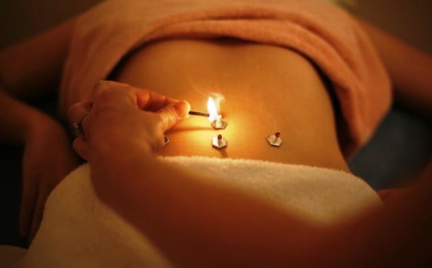 Moxibustion For Chinese Accupuncture