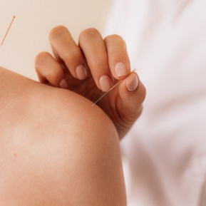 Can Acupuncture Help Anxiety